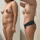 Slider image (9) Dr. Gabriel Sandoval - Plastic Surgeon in Mexico